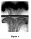 Fig. 08 - Nucleic acids encoding monomers of a type II serine proteinase inhibitor