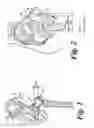 Fig. 02 - Hip Protector