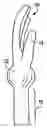 Fig. 01 - Surgicl Glove