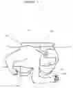 Fig. 04 - Medical support pillow