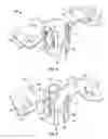 Fig. 02 - Retention clip