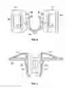 Fig. 06 - Retention clip