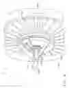 Fig. 06 - Installation tool for assembling a rotor blade of a gas turbine engine fan assembly