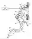 Fig. 01 - Accelerator pedal system