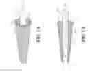 Fig. 02 - Methods, systems and devices for performing gynecological procedures