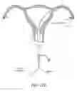 Fig. 14 - Methods, systems and devices for performing gynecological procedures