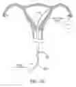 Fig. 15 - Methods, systems and devices for performing gynecological procedures