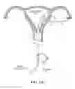 Fig. 19 - Methods, systems and devices for performing gynecological procedures