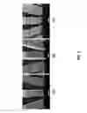 Fig. 04 - Dislocation reduction in non-polar III-nitride thin films