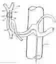 Fig. 01 - Balloon catheter, its fabrication method, and method for fixedly mounting a balloon on catheter tube