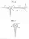 Fig. 06 - Balloon catheter, its fabrication method, and method for fixedly mounting a balloon on catheter tube