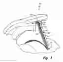Fig. 02 - Brush seal assemblies utilizing a threaded fastening method