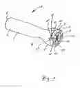 Fig. 02 - Ignition anode, in particular for reignitable rocket combustion chambers