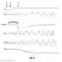 Fig. 05 - Reducing noise during a gain change