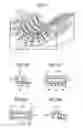 Fig. 03 - Radiological imaging apparatus