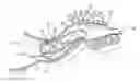 Fig. 01 - Semi-permanent canal hearing device and insertion method