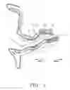Fig. 02 - Semi-permanent canal hearing device and insertion method