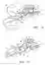Fig. 09 - Semi-permanent canal hearing device and insertion method