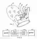 Fig. 02 - Audio enhanced decorative thermal insulating hand protector
