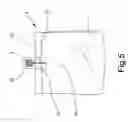 Fig. 06 - Quick cropper bag