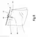 Fig. 09 - Quick cropper bag