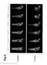 Fig. 07 - Radioactive tyrosine derivative, method for producing same, labeling agent for positron imaging and medical agent for assessing grade of malignancy of tumor respectively composed of radioactive tyrosine derivative, and method for detecting tumor