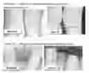 Fig. 01 - Cosmetic and pharmaceutical foam