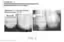 Fig. 03 - Cosmetic and pharmaceutical foam