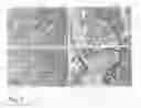Fig. 03 - Diagnostic and therapeutic methods based on the L1 adhesion molecule for ovarian and endometrial tumors
