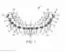 Fig. 02 - ORTHODONTIC BRACE WITH REDUCED PROFILE
