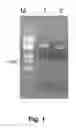 Fig. 02 - Expression System for Recombinant Human Arginase I
