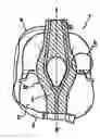 Fig. 01 - Lifejacket