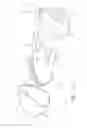 Fig. 08 - Golf club head