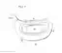 Fig. 06 - Golf club head