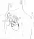 Fig. 01 - Heart assist devices, systems and methods