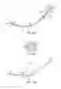 Fig. 09 - System, methods and devices relating to delivery of medical implants