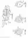 Fig. 49 - System, methods and devices relating to delivery of medical implants