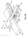 Fig. 35 - Methods and devices for stabilizing tissue