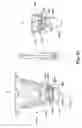 Fig. 85 - Methods and devices for stabilizing tissue