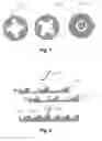 Fig. 06 - Medication delivery system with a detector for providing a signal indicative of an amount of a set and/or ejected dose of drug