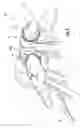 Fig. 06 - Utility hand-piece with integrated fluid channel