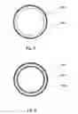 Fig. 04 - Article to be inserted in a body cavity having biologically inhibiting surfaces and use and preparation of the article