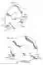 Fig. 10 - System and method for determining a position for a scleral pocket for a scleral prosthesis