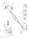 Fig. 02 - Electric plasma-mediated cutting and coagulation of tissue and surgical apparatus