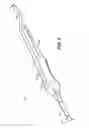 Fig. 03 - Electric plasma-mediated cutting and coagulation of tissue and surgical apparatus