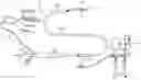 Fig. 01 - MULTI-ELECTRODE APPARATUS FOR TISSUE WELDING AND ABLATION