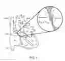 Fig. 02 - MULTI-ELECTRODE APPARATUS FOR TISSUE WELDING AND ABLATION