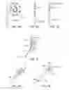 Fig. 09 - MULTI-ELECTRODE APPARATUS FOR TISSUE WELDING AND ABLATION