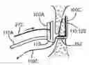 Fig. 01 - MULTI-ELECTRODE APPARATUS FOR TISSUE WELDING AND ABLATION
