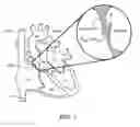 Fig. 02 - MULTI-ELECTRODE APPARATUS FOR TISSUE WELDING AND ABLATION